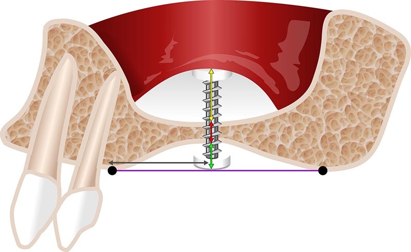 Ilustração para artigo de odontologia.